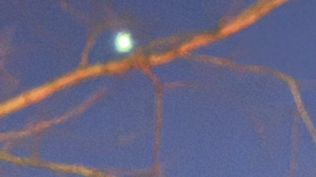 Woman Claims to Be Visited by Aliens and Orbs – The UFO Drama Continues