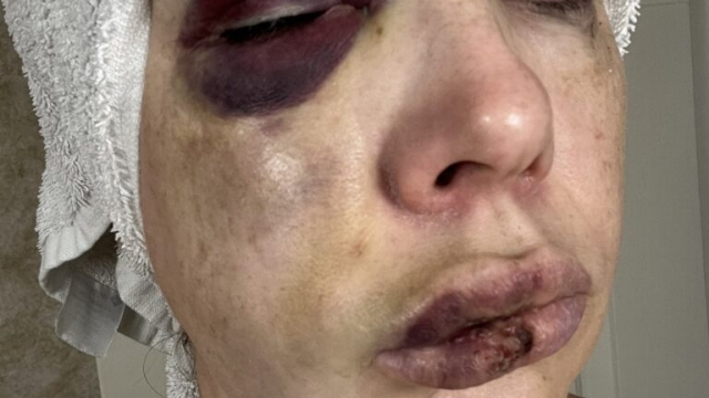 Brutal Attack in Cincinnati Sparks Federal Scrutiny Amid Rising Hate Crime Concerns